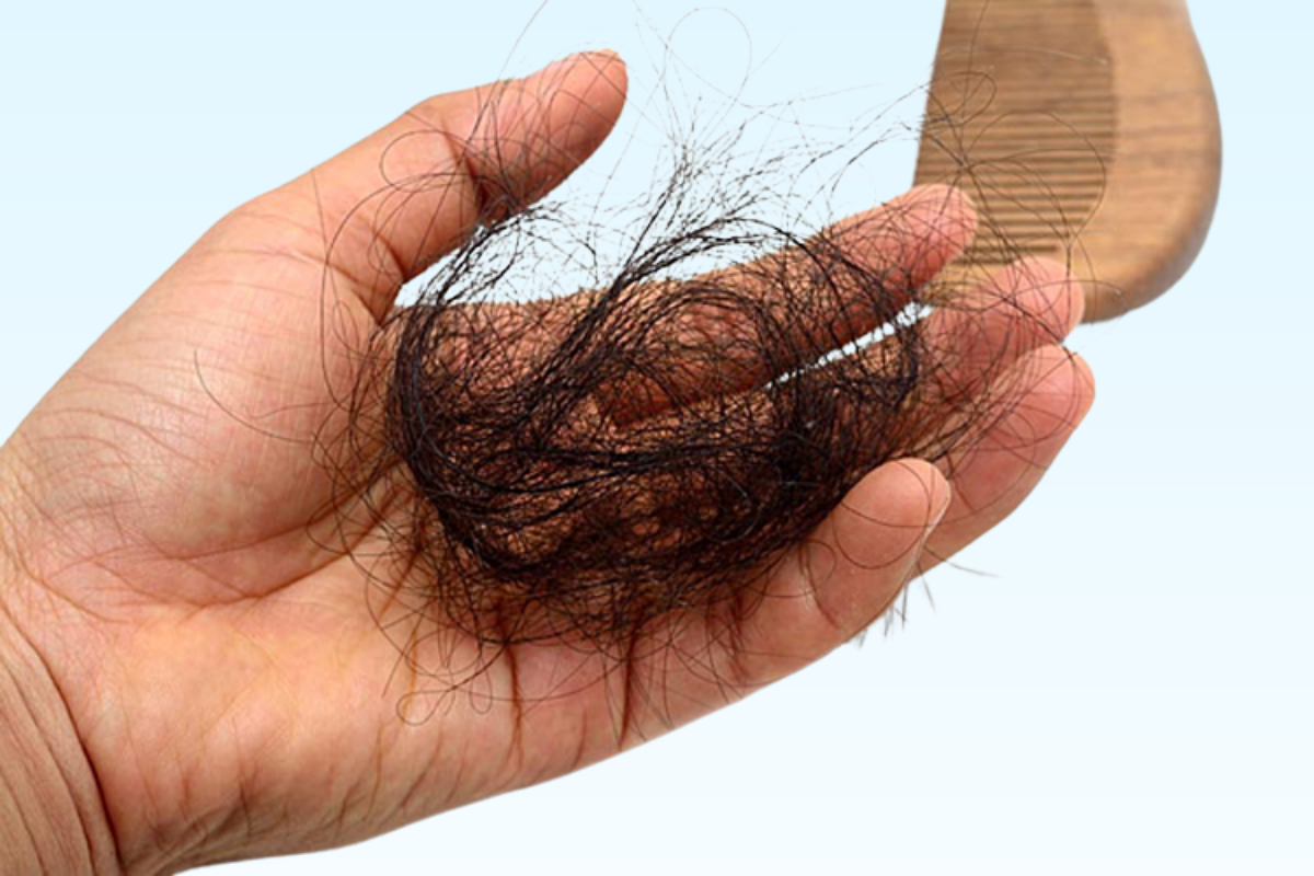 Vì sao tóc bạn rụng ngày càng nhiều?