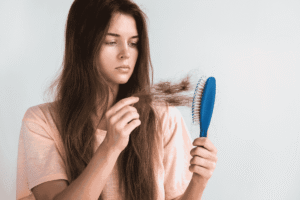 Noi lo rung toc cua nhieu nguoi hien nay