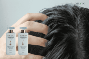 Dầu gội cho da đầu nhờn