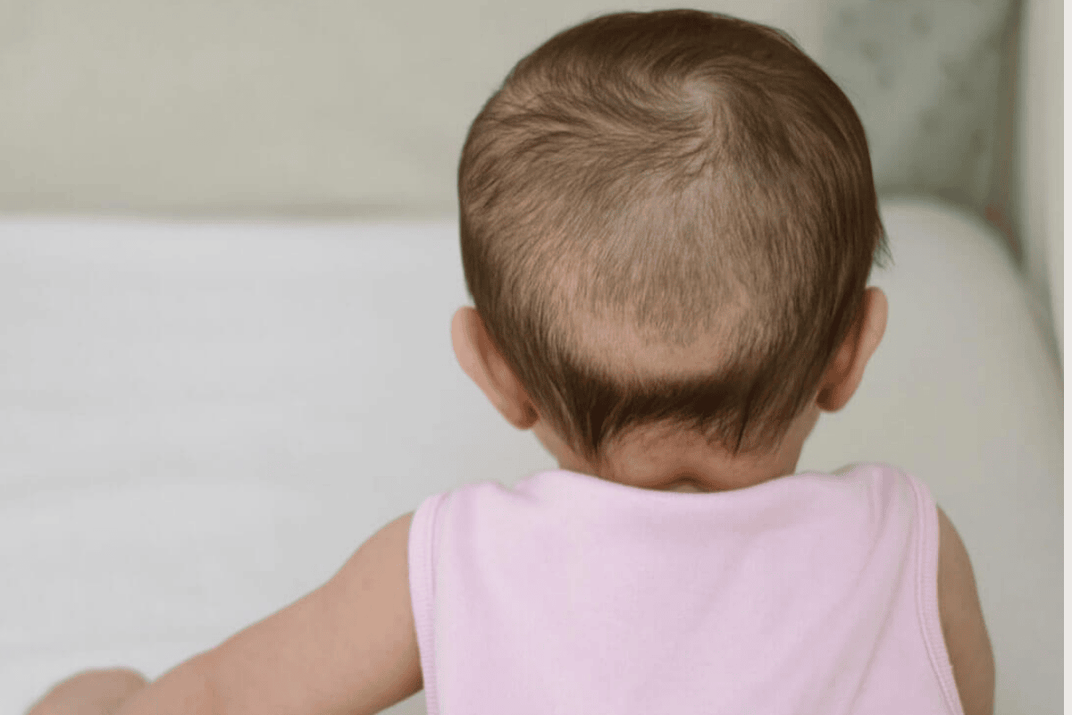 Phân biệt rụng tóc sinh lý và rụng tóc do thiếu chất ở trẻ