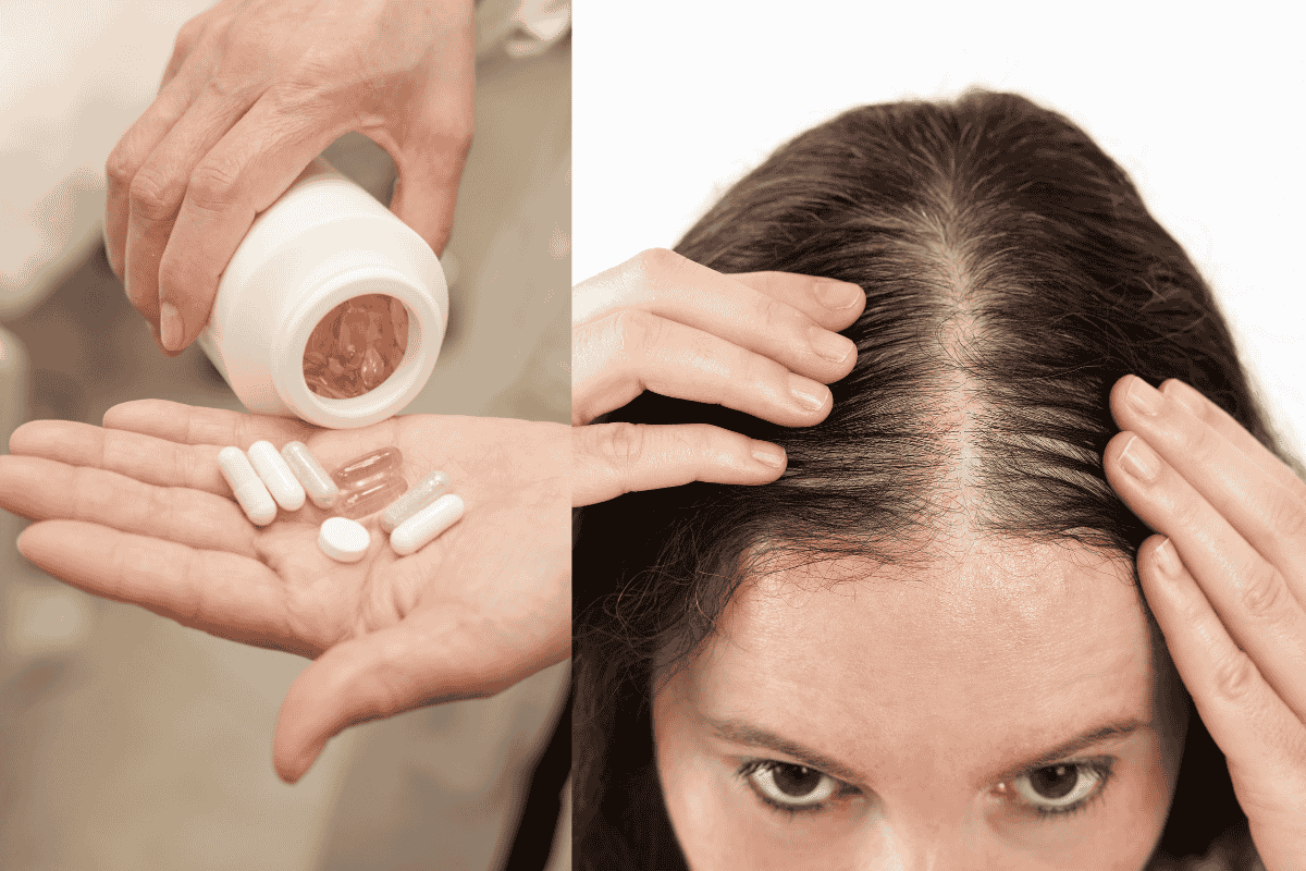 Sự thật về viên uống mọc tóc trên thị trường hiện nay